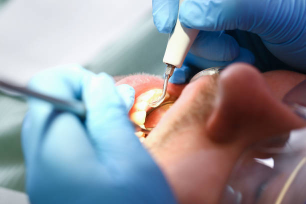 Best Emergency Tooth Extraction  in Laurens, IA